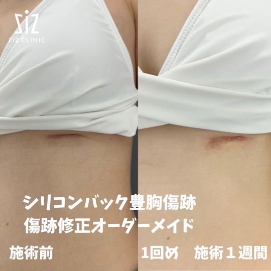 記事で紹介された画像